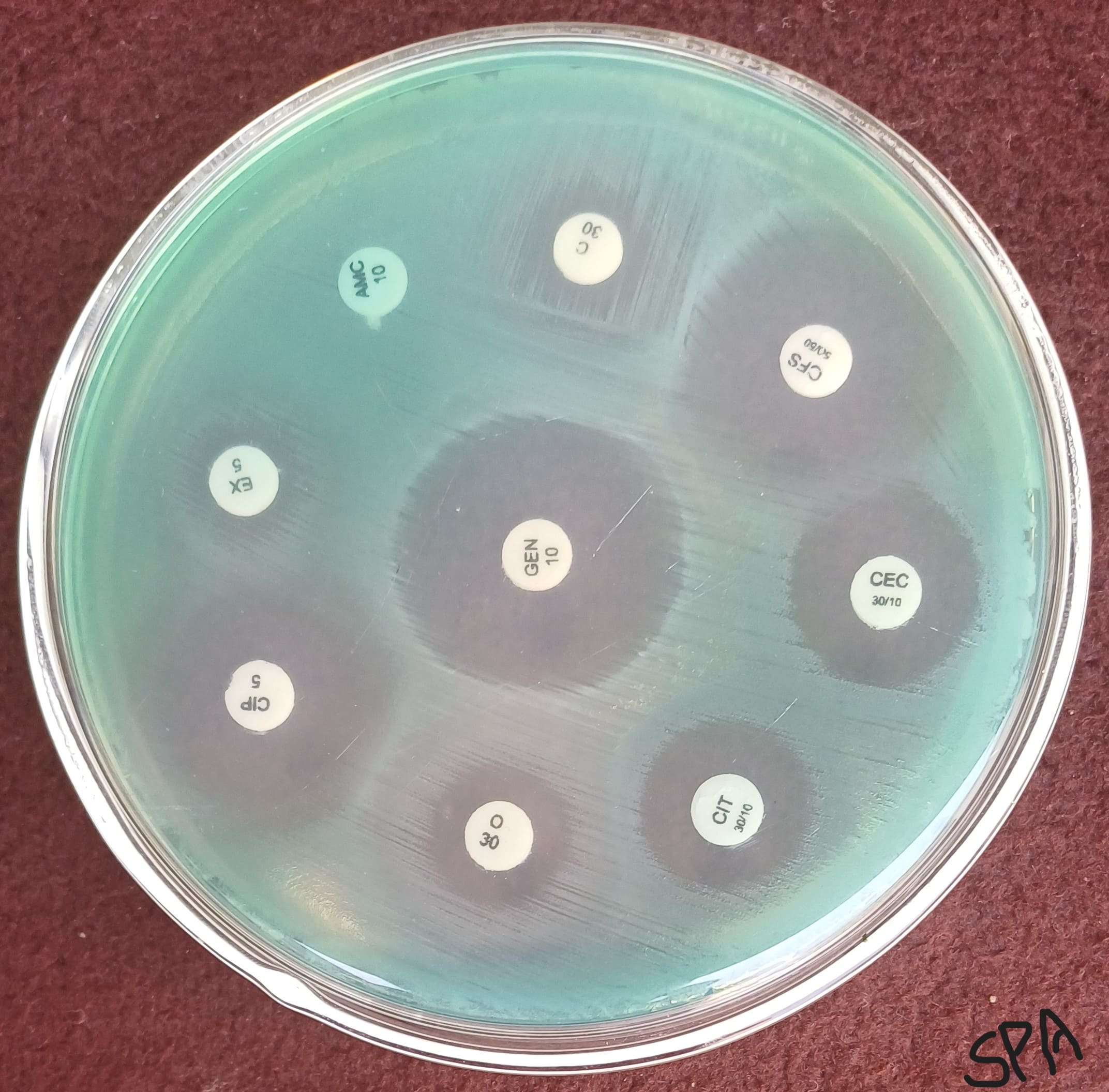 17. Pseudomonas (pyocyanin)